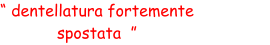 “ dentellatura fortemente  spostata  ”