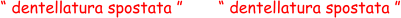 “ dentellatura spostata ” “ dentellatura spostata ”